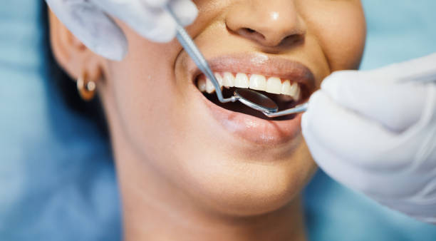 Fast & Reliable Emergency Dental Services in CA